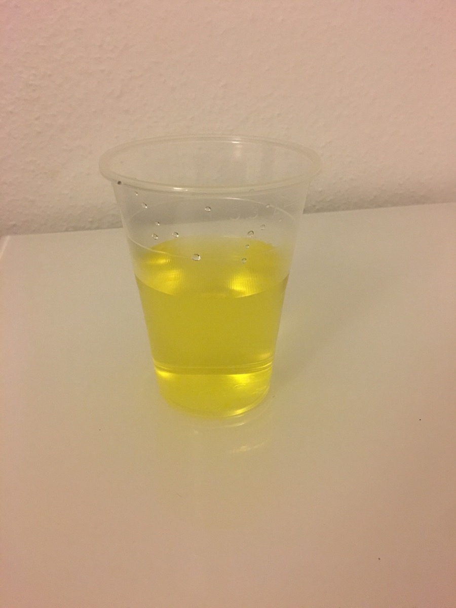 Urin in gold-gelber Farbe